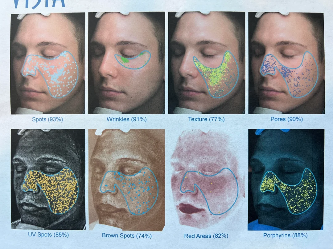 Reference skin analysis image showing different imaging views