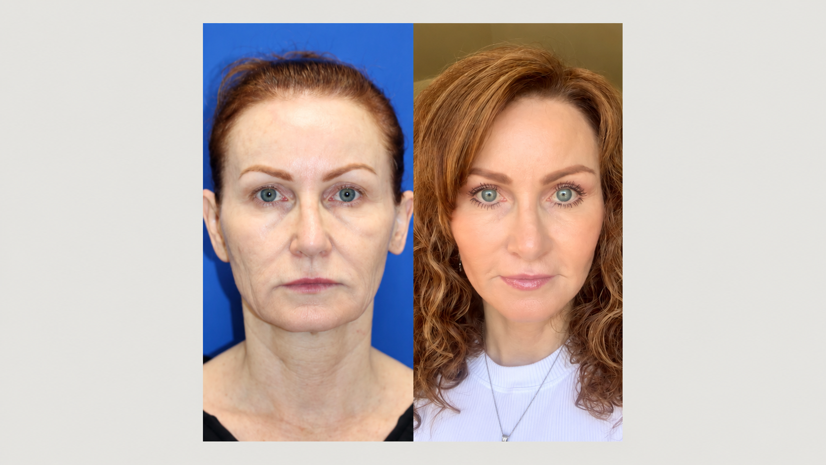 Skin appearance comparison