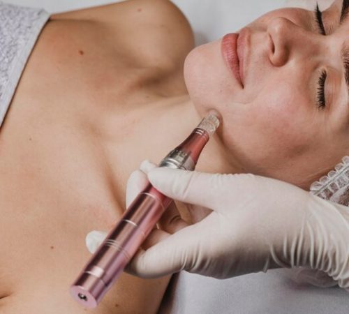 SKINPEN MICRONEEDLING